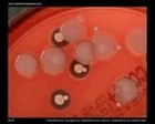 pseudomonas aeruginosa hemolysis on blood agar